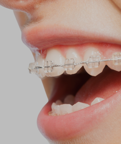 Treatments - Premier Dental Care & Implant Centre