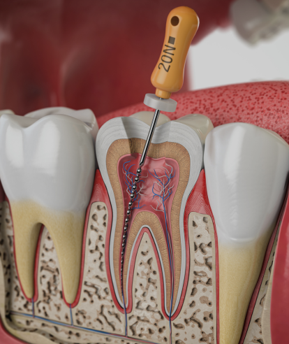 Treatments - Premier Dental Care & Implant Centre