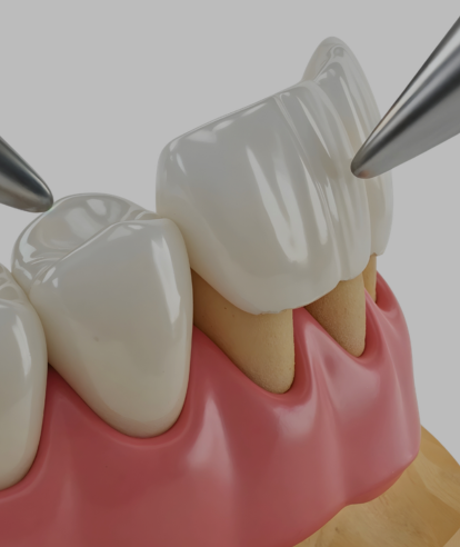 Treatments - Premier Dental Care & Implant Centre