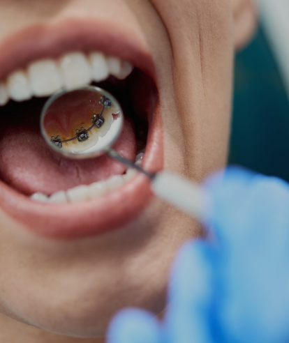 Treatments - Premier Dental Care & Implant Centre