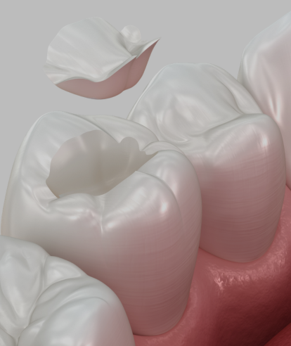 Treatments - Premier Dental Care & Implant Centre