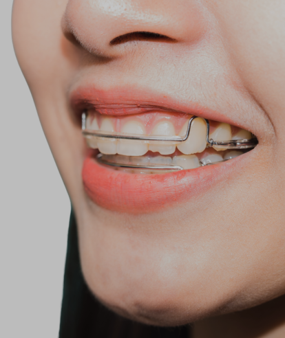 Treatments - Premier Dental Care & Implant Centre